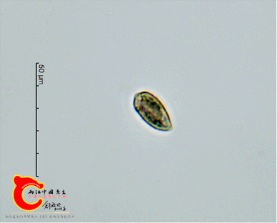 卵圆双菱藻Surirellaovalis.png
