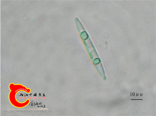 卵形双菱藻Surirella ovata.png