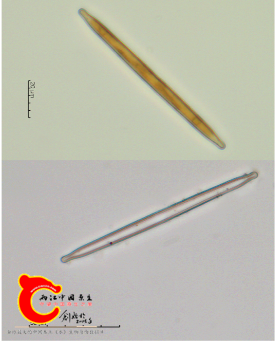 肘状针杆藻Synedra ulna.png