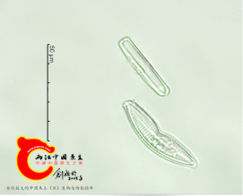 切断桥弯藻Cymbellaexcisa.png
